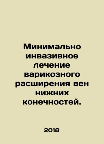 Minimalno invazivnoe lechenie varikoznogo rasshireniya ven nizhnikh konechnostey./Minimally invasive treatment for varicose veins in the lower limbs. In Russian - landofmagazines.com