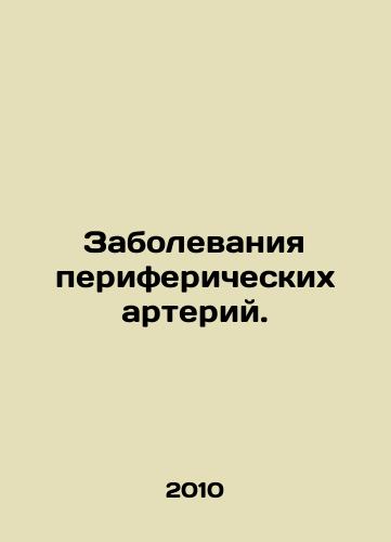 Zabolevaniya perifericheskikh arteriy./Peripheral artery diseases. In Russian - landofmagazines.com