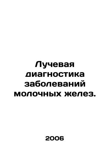 Luchevaya diagnostika zabolevaniy molochnykh zhelez./Radiodiagnosis of breast diseases. In Russian - landofmagazines.com