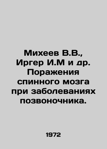 Mikheev V.V.,  Irger I.M i dr. Porazheniya spinnogo mozga pri zabolevaniyakh pozvonochnika./Mikheev V.V.,  Irger I.M et al. Spinal cord lesions in diseases of the spine. In Russian - landofmagazines.com