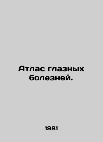 Atlas glaznykh bolezney./Atlas of eye diseases. In Russian - landofmagazines.com