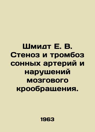 Shmidt E. V. Stenoz i tromboz sonnykh arteriy i narusheniy mozgovogo kroobrashcheniya./Schmidt E. V. Stenosis and thrombosis of carotid arteries and cerebrovascular disorders. In Russian - landofmagazines.com