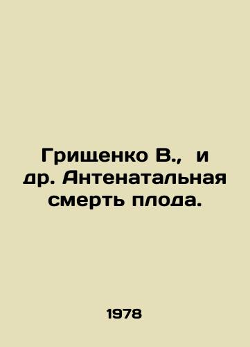 Grishchenko V.,  i dr. Antenatalnaya smert ploda./Grishchenko V. et al. Antenatal death of the fetus. In Russian - landofmagazines.com