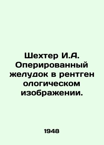 Shekhter I.A. Operirovannyy zheludok v rentgenologicheskom izobrazhenii./Shechter I.A. An operated stomach in an X-ray image. In Russian - landofmagazines.com