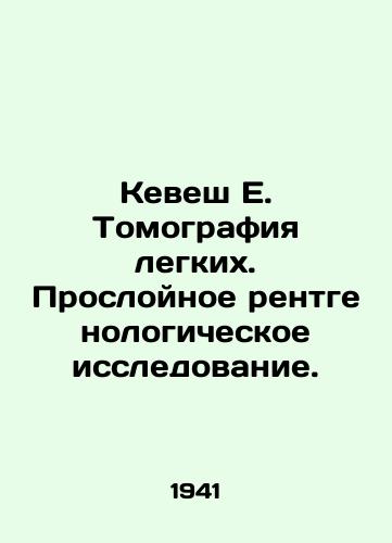 Kevesh E. Tomografiya legkikh. Prosloynoe rentgenologicheskoe issledovanie./Kevesh E. Lung tomography. Layer X-ray examination. In Russian - landofmagazines.com