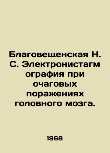 Blagoveshchenskaya N. S. Elektronistagmografiya pri ochagovykh porazheniyakh golovnogo mozga./Blagoveshchenskaya N. S. Electronistagmography for central brain lesions. In Russian - landofmagazines.com